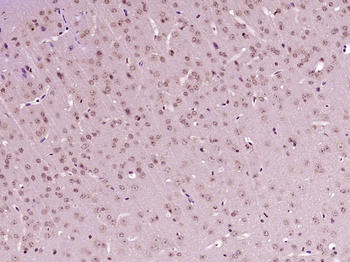 MECR Rabbit Polyclonal Antibody