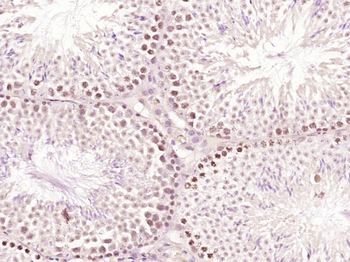 MED8 Rabbit Polyclonal Antibody