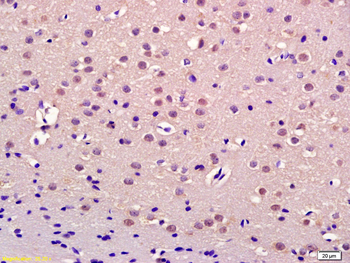 Thrap3 Rabbit Polyclonal Antibody