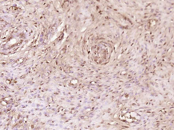 MEX3C Rabbit Polyclonal Antibody