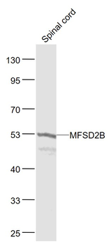MFSD2B Rabbit Polyclonal Antibody