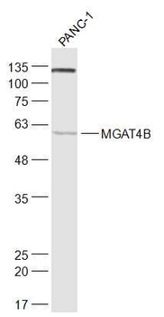 MGAT4B Rabbit Polyclonal Antibody