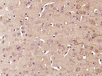 MGAT5B Rabbit Polyclonal Antibody