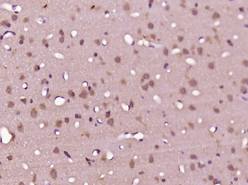 NUDCD3 Rabbit Polyclonal Antibody