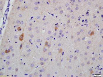 NF-H Rabbit Polyclonal Antibody