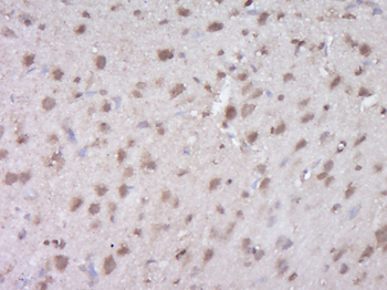 ODCp Rabbit Polyclonal Antibody