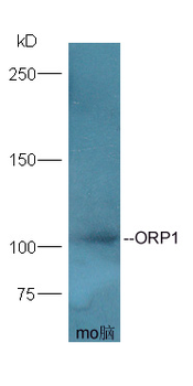 ORP1 Rabbit Polyclonal Antibody