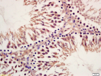 ORP1 Rabbit Polyclonal Antibody