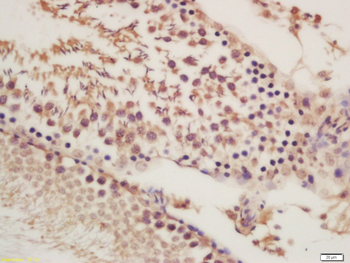ORP1 Rabbit Polyclonal Antibody