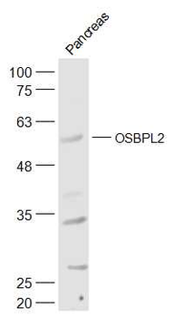 OSBPL2 Rabbit Polyclonal Antibody