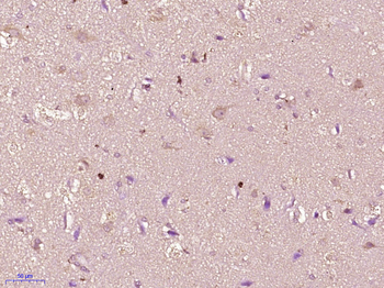 OSBPL5 Rabbit Polyclonal Antibody