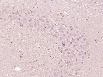 OSBPL5 Rabbit Polyclonal Antibody
