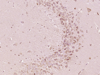 Otoferlin Rabbit Polyclonal Antibody