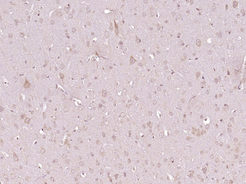 Otoferlin Rabbit Polyclonal Antibody