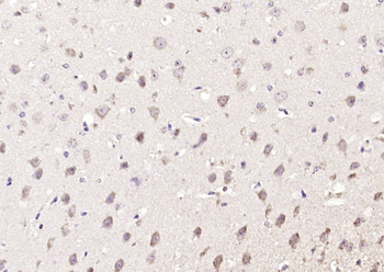 ZNF804A Rabbit Polyclonal Antibody