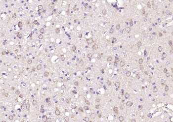 ZNF804A Rabbit Polyclonal Antibody