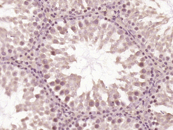 OTUD1 Rabbit Polyclonal Antibody