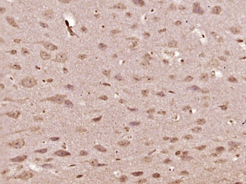 OXA1L Rabbit Polyclonal Antibody