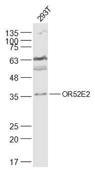 OR52E2 Rabbit Polyclonal Antibody