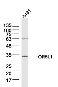 OR5L1 Rabbit Polyclonal Antibody