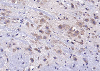 OTC/Ornithine Carbamoyltransferase Rabbit Polyclonal Antibody