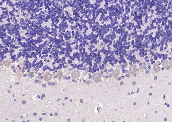 OTC/Ornithine Carbamoyltransferase Rabbit Polyclonal Antibody