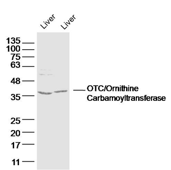 OTC/Ornithine Carbamoyltransferase Rabbit Polyclonal Antibody
