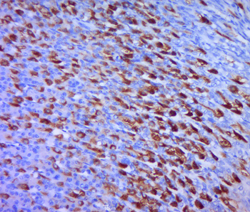 PIAS4/PIASy Rabbit Polyclonal Antibody