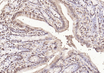 RPS6KA1 Rabbit Polyclonal Antibody