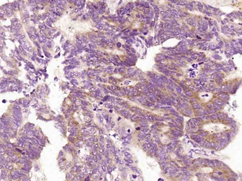 AKT1S1 Rabbit Polyclonal Antibody