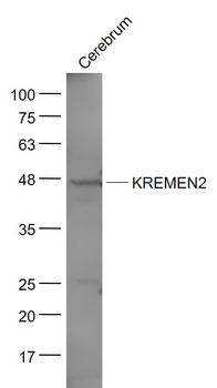 KREMEN2 Rabbit Polyclonal Antibody