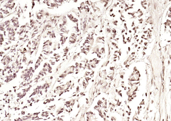 PIK3R5 Rabbit Polyclonal Antibody