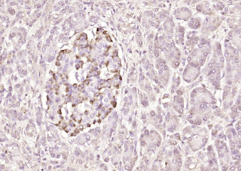 PIK3R5 Rabbit Polyclonal Antibody