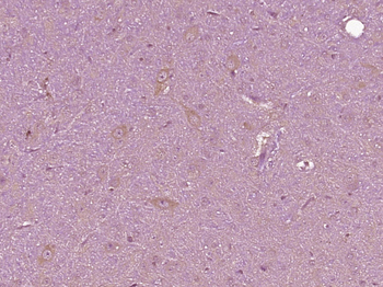 Robo3 Rabbit Polyclonal Antibody