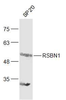 RSBN1 Rabbit Polyclonal Antibody