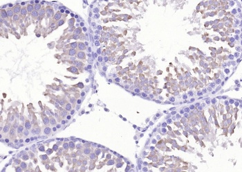 Src antibody