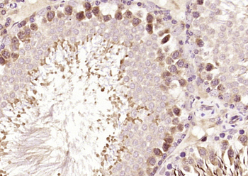 Syntaxin 12 Rabbit Polyclonal Antibody