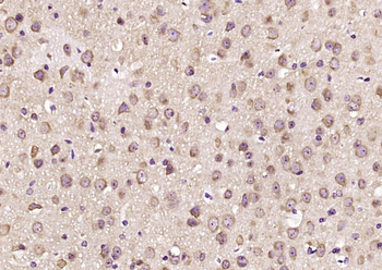Syntaxin 12 Rabbit Polyclonal Antibody