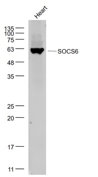 SOCS6 antibody