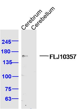 FLJ10357 Rabbit Polyclonal Antibody