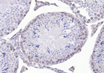 SBNO1 Rabbit Polyclonal Antibody