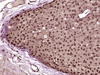 SC35 Rabbit Polyclonal Antibody