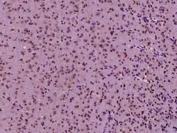 SC35 Rabbit Polyclonal Antibody