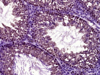 SC35 Rabbit Polyclonal Antibody