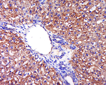 SCARA5 Rabbit Polyclonal Antibody