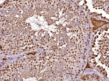 SCCPDH Rabbit Polyclonal Antibody