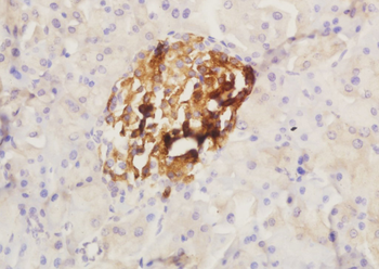 SCIN Rabbit Polyclonal Antibody