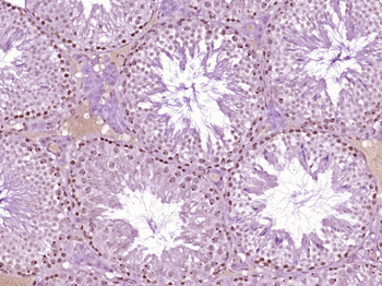 SCML2 Rabbit Polyclonal Antibody