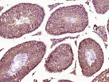 SCNM1 Rabbit Polyclonal Antibody