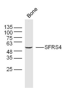 SFRS4 Rabbit Polyclonal Antibody